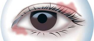 CBA***得分手發(fā)高燒吸氧0得分 教練：賓館房間新裝修，甲醛中毒導(dǎo)致的！