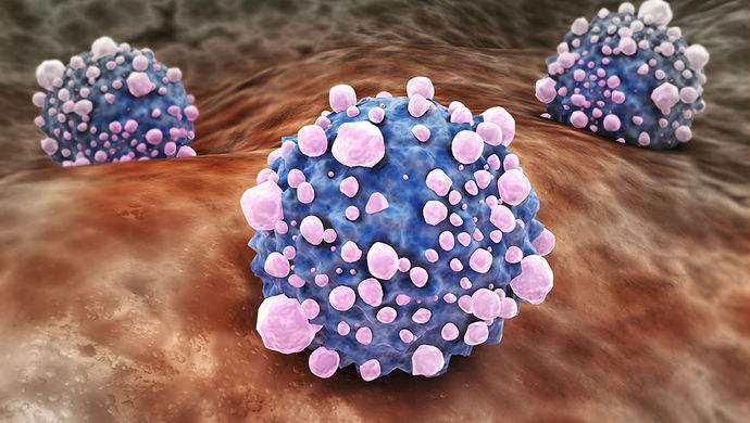 平時(shí)不注意甲醛超標(biāo)，50歲女子劇烈頭痛、惡心干嘔，一查已是癌癥晚期！