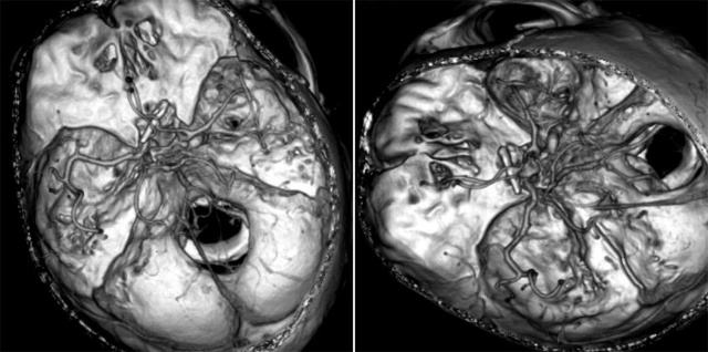 平時(shí)不注意甲醛超標(biāo)，50歲女子劇烈頭痛、惡心干嘔，一查已是癌癥晚期！