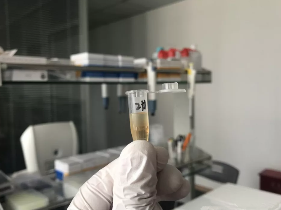 水煮花生含甲醛？實(shí)測(cè)多家燒烤店結(jié)果太可怕！