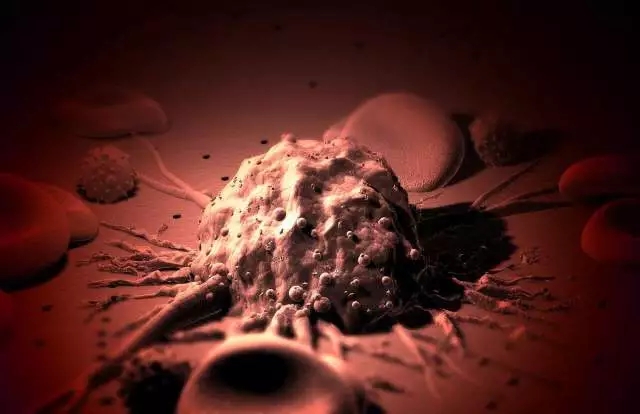 癌癥、白血病越來越多，是因?yàn)闀r(shí)代在進(jìn)步而導(dǎo)致的嗎？